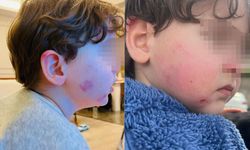 2 yaşındaki çocuk kreşte darp edildi