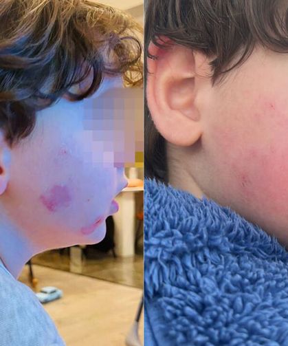 2 yaşındaki çocuk kreşte darp edildi